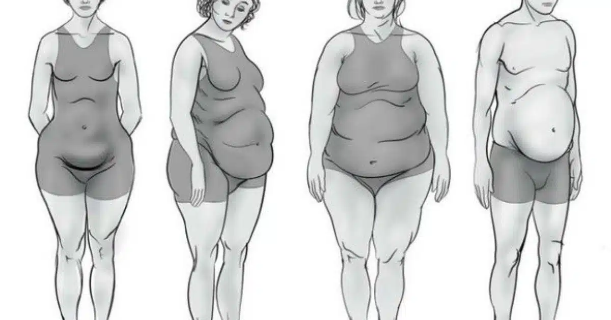 Quel déséquilibre hormonal vous concerne ? Déterminez-le selon votre type de silhouette