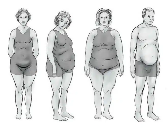 Quel déséquilibre hormonal vous concerne ? Déterminez-le selon votre type de silhouette