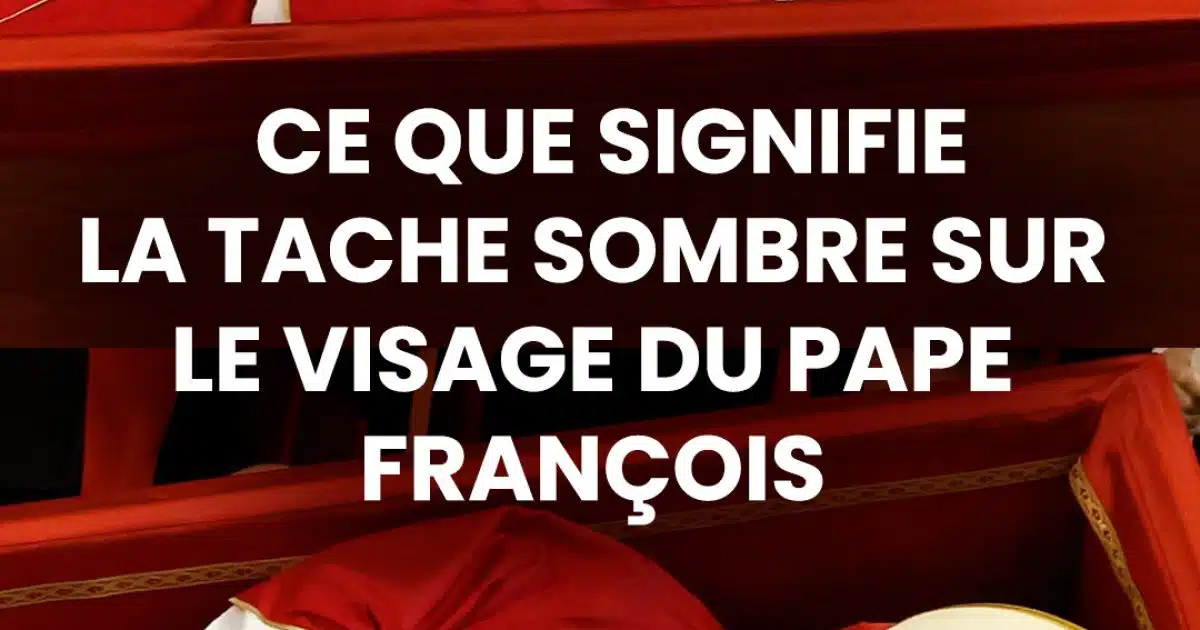 Quelle est cette tache sombre visible sur le visage du Pape François : les hypothèses des experts