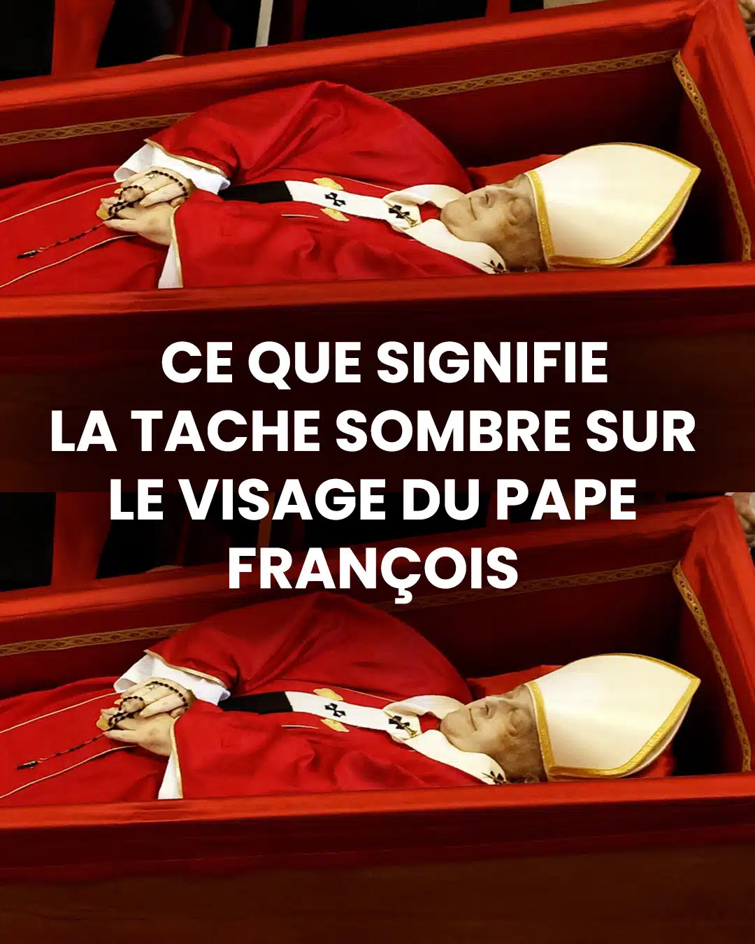 Quelle est cette tache sombre visible sur le visage du Pape François : les hypothèses des experts