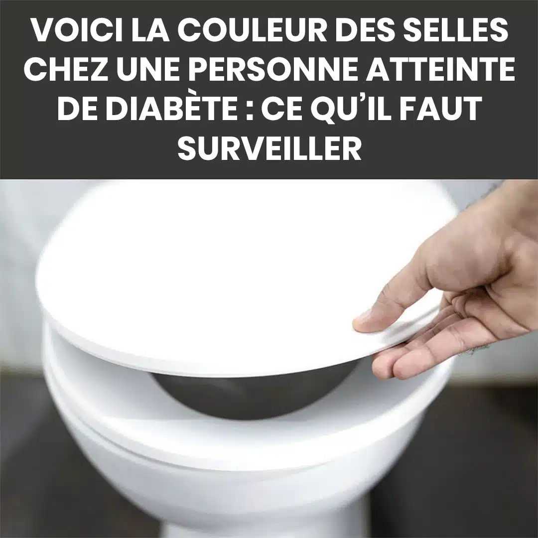 Quelle est la couleur des selles d'une personne diabétique ? Voici ce qu'il faut retenir