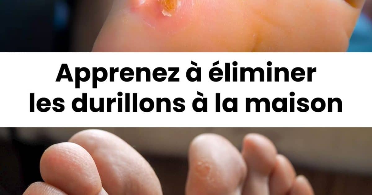 Quelles sont les méthodes pour éliminer les durillons ?