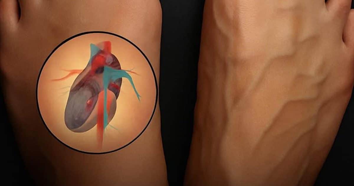 Quels sont les signes avant-coureurs d’une crise cardiaque ?