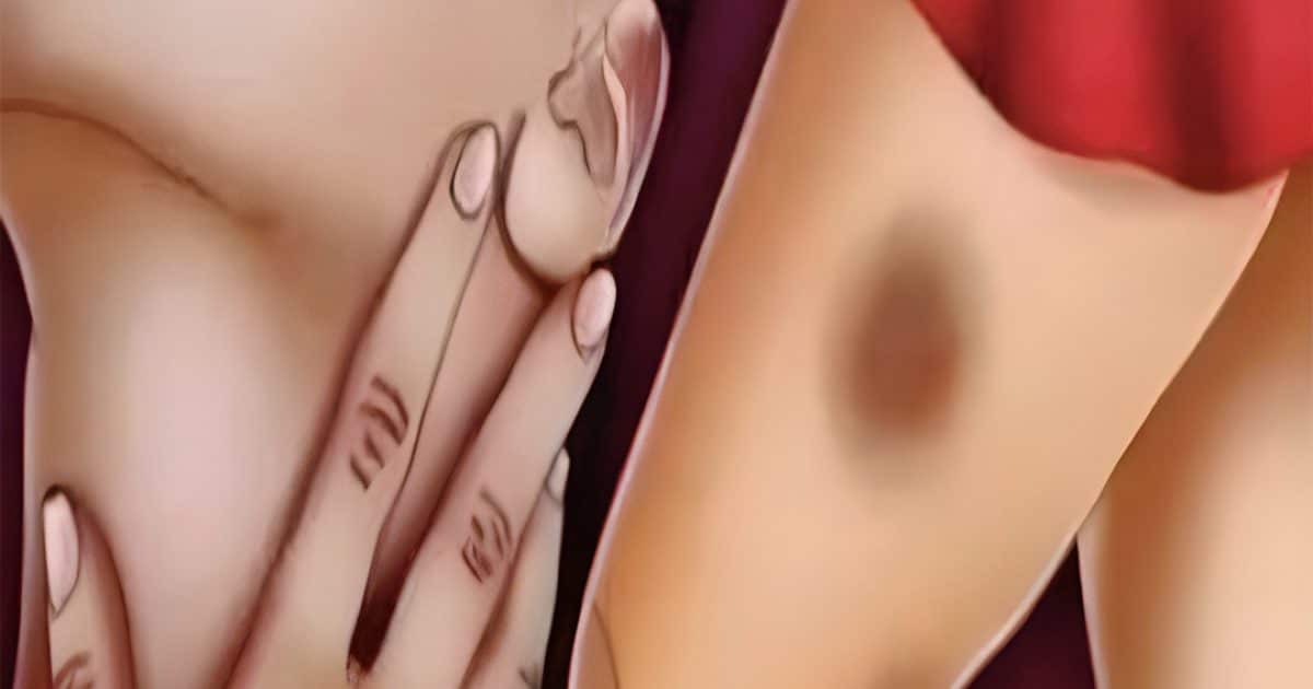 Qu’est-ce que la leucémie ? Causes, symptômes et comment prévenir cette maladie
