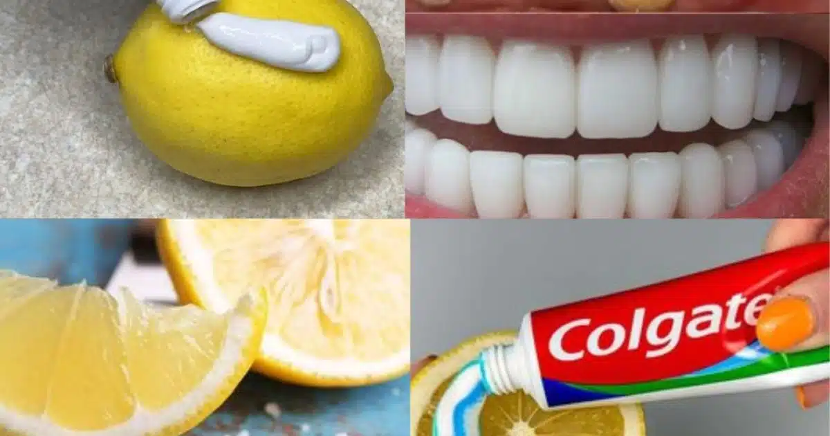Recette naturelle pour blanchir les dents avec du citron