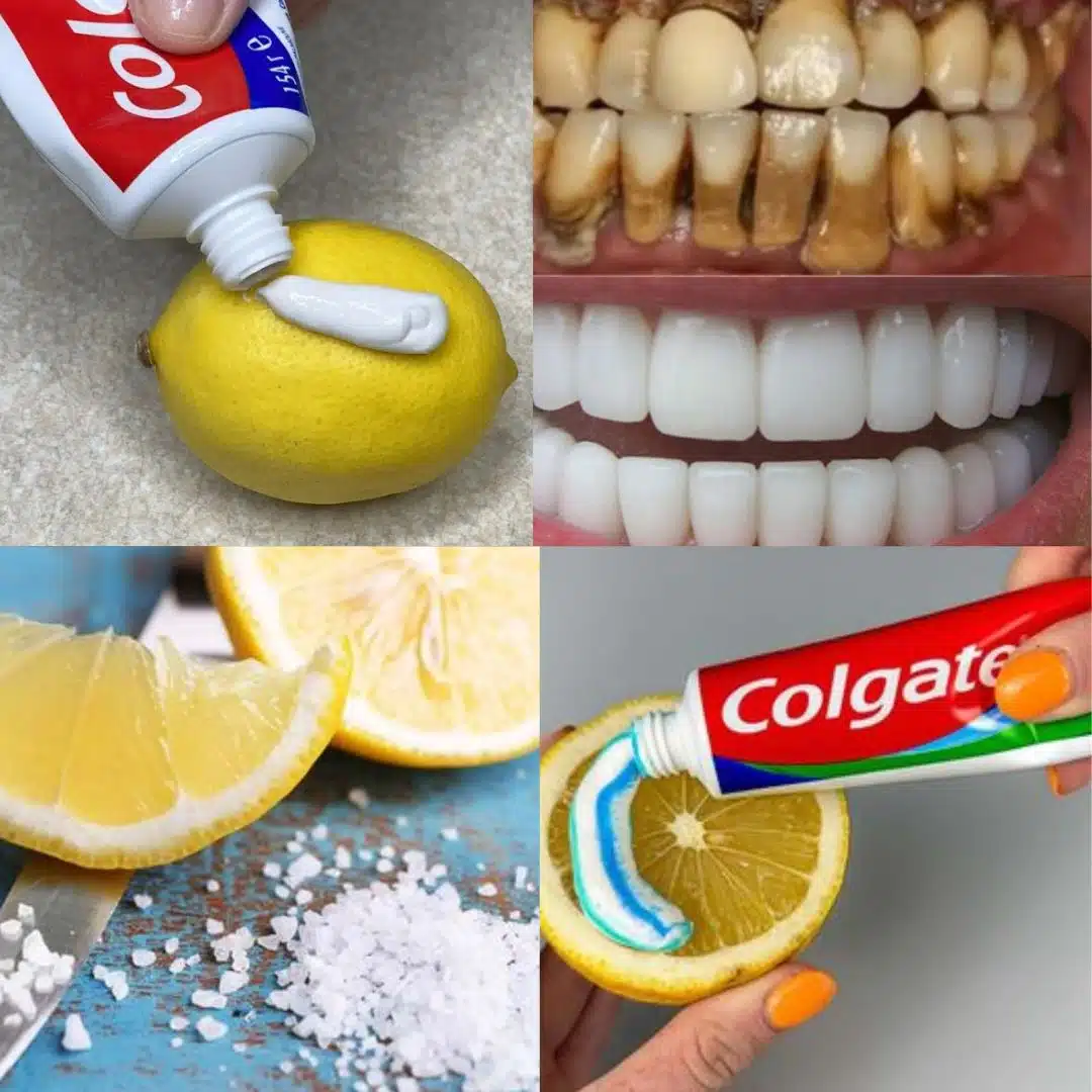 Recette naturelle pour blanchir les dents avec du citron