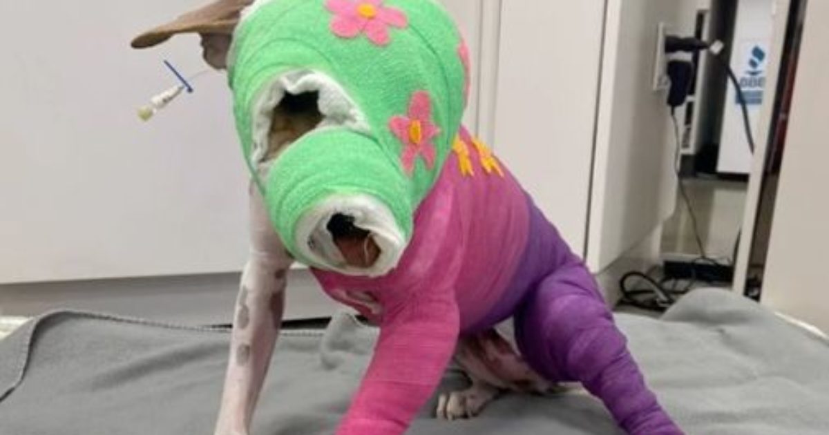 Riona a subi de terribles brûlures – après une année de convalescence, elle s’apprête enfin à emménager dans sa nouvelle maison