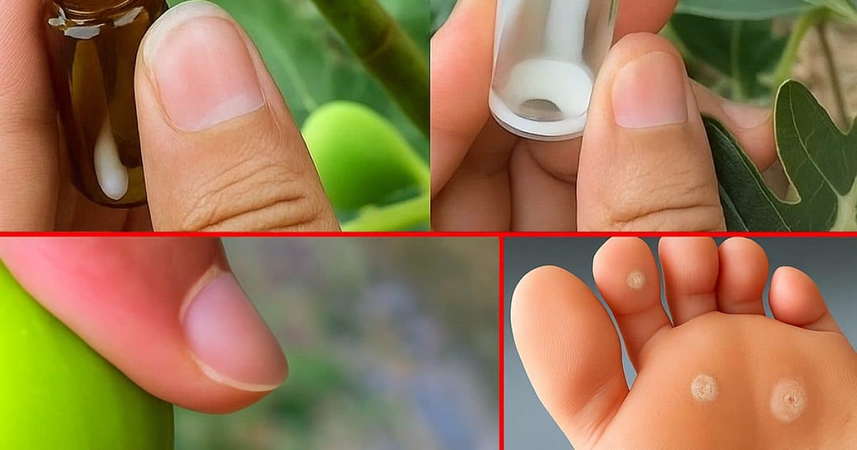 Sève de figuier : le remède discret de la nature pour la peau, la digestion et le bien-être au quotidien