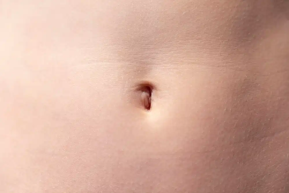 Nombril de forme ronde ou ovale