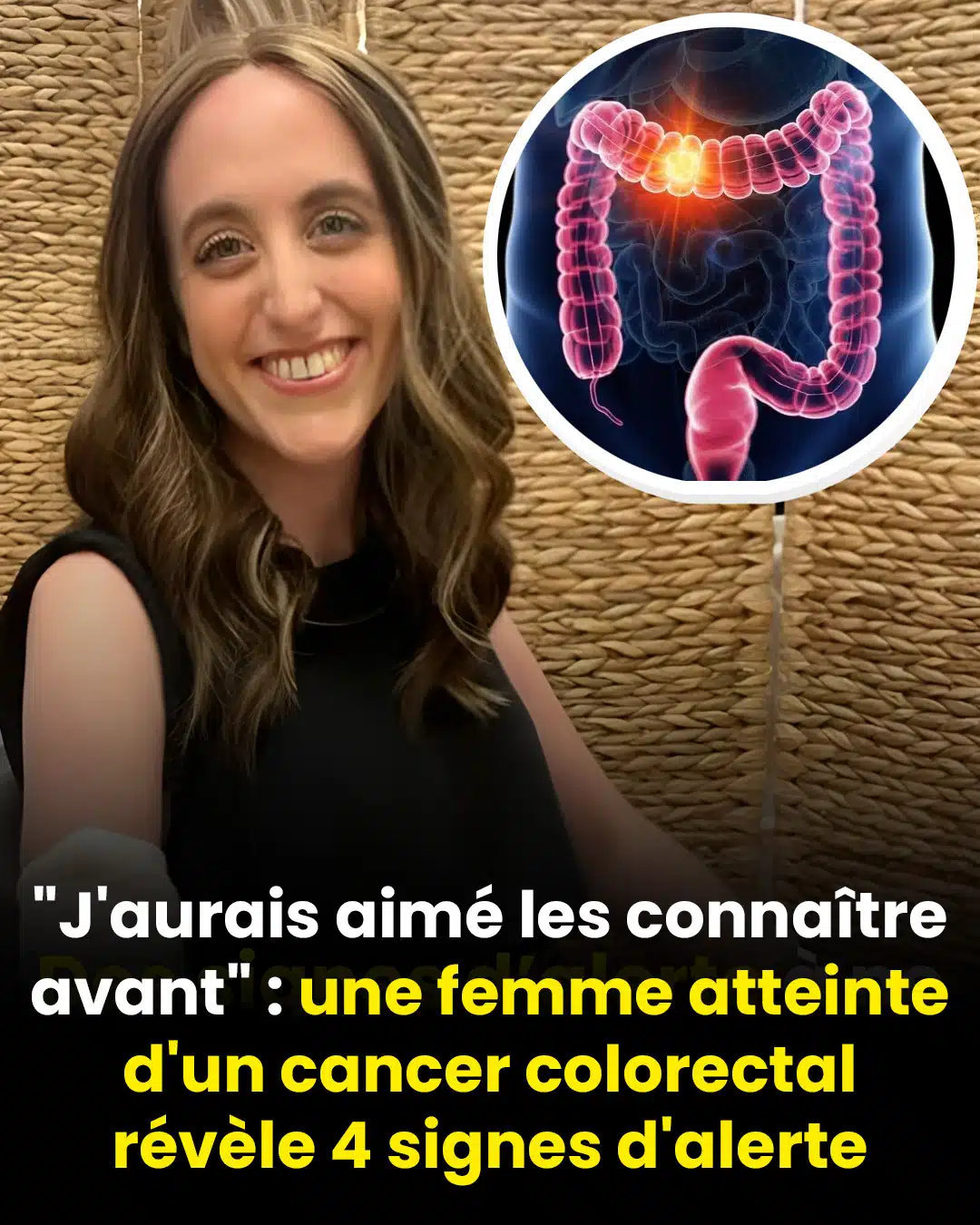 "Si seulement je les avais su plus tôt" : une femme atteinte d'un cancer colorectal partage 4 symptômes à surveiller