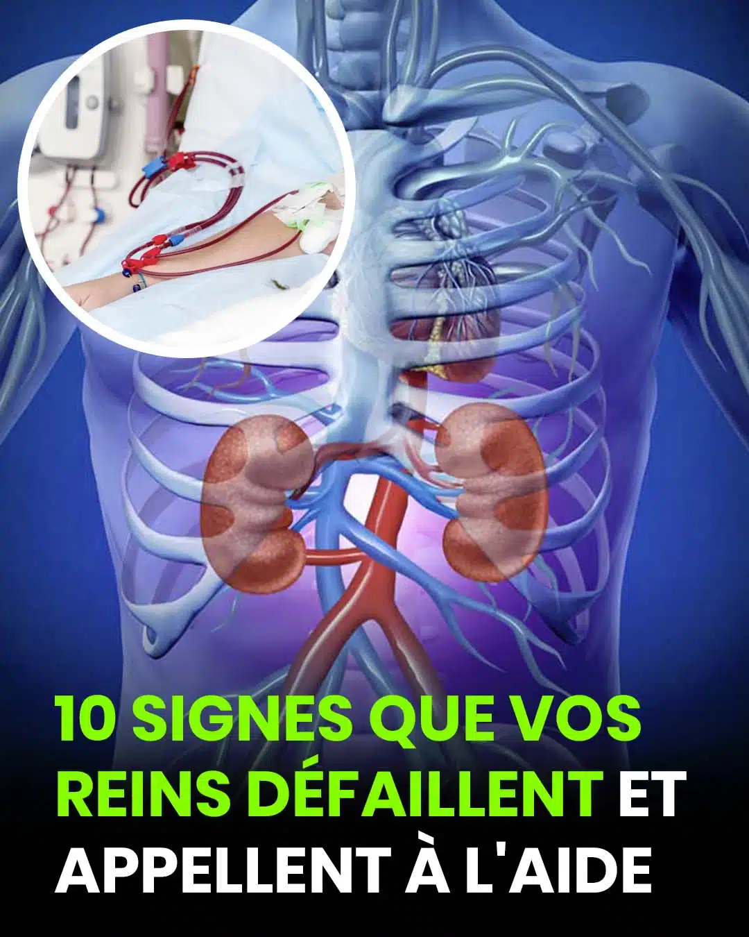 Si vos reins sont en danger, le corps montrera ces 10 signes