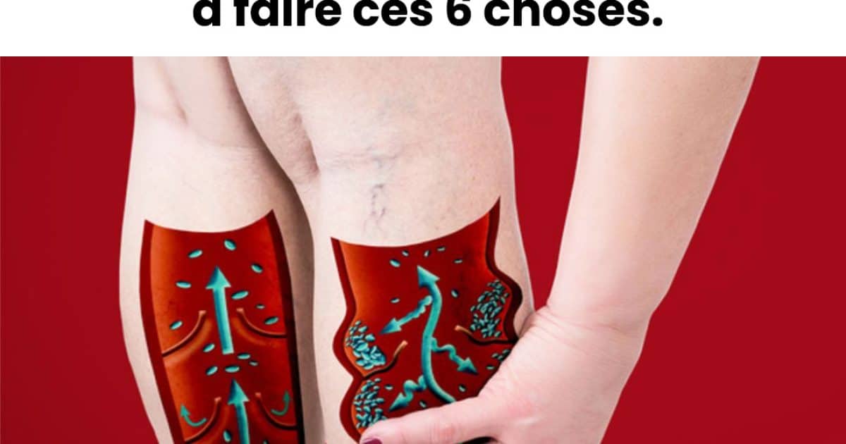 Si vous avez une mauvaise circulation, des pieds froids ou des varices, commencez à faire ces choses
