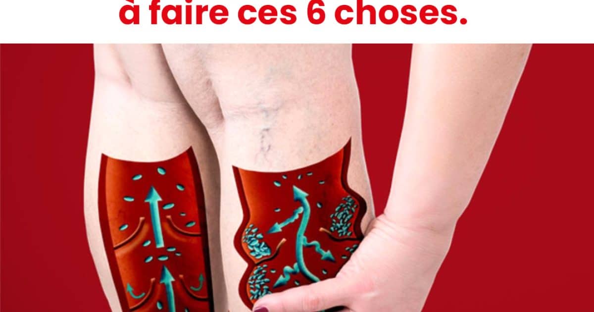 Si vous avez une mauvaise circulation, les pieds froids ou des varices, commencez à faire ces choses