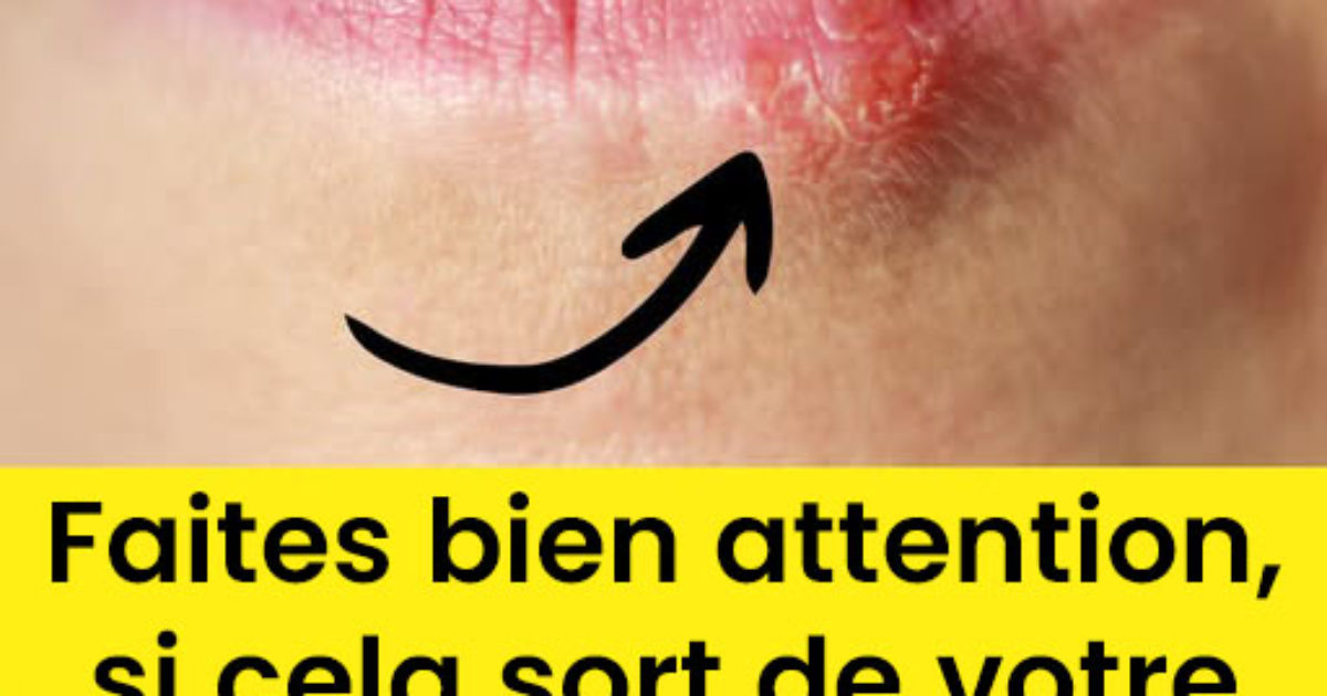 Si vous observez ce changement dans votre bouche, c'est un signal important que votre corps vous envoie