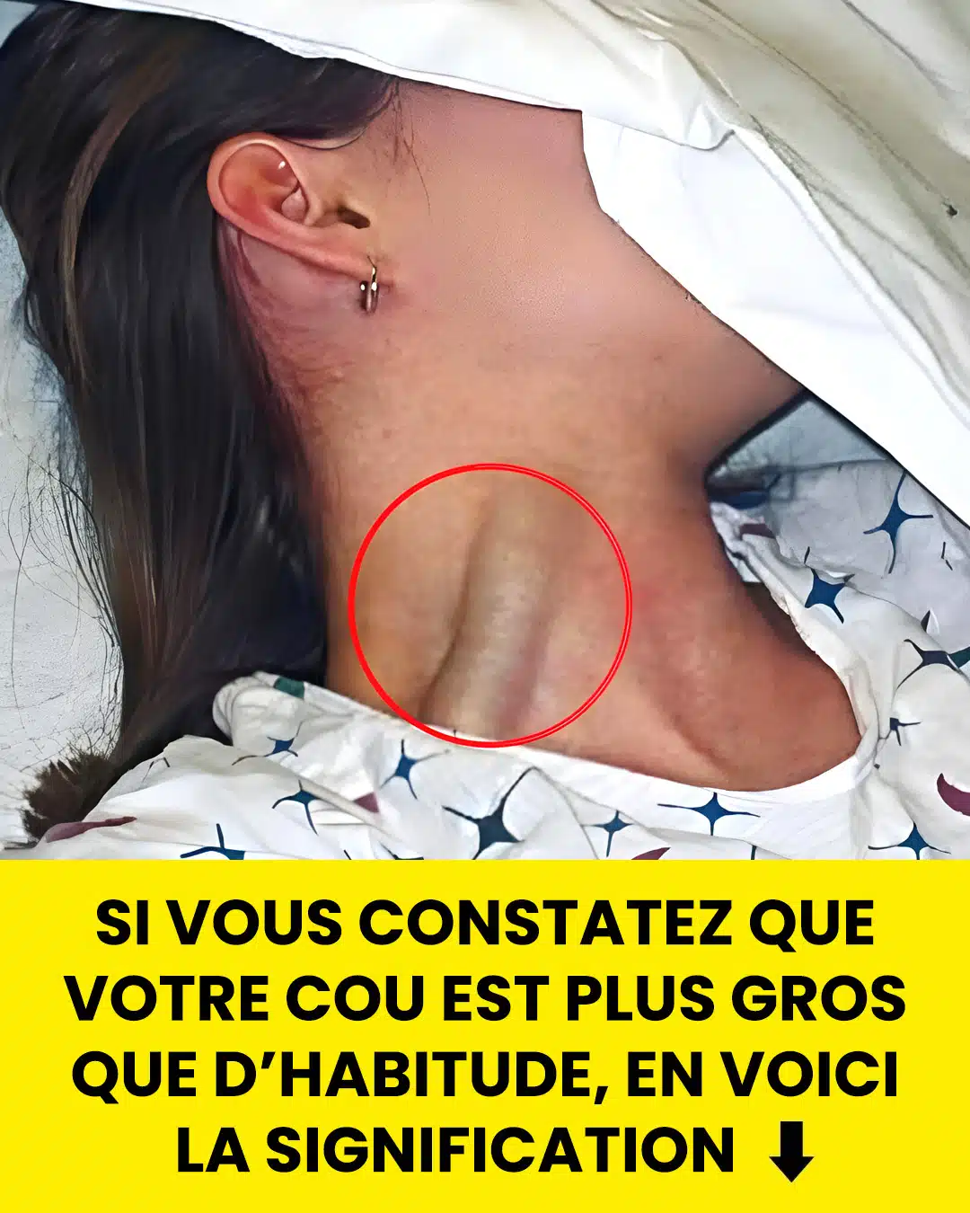 Si vous remarquez que votre cou est plus gros que d’habitude, c’est un signe qu’il ne faut pas ignorer