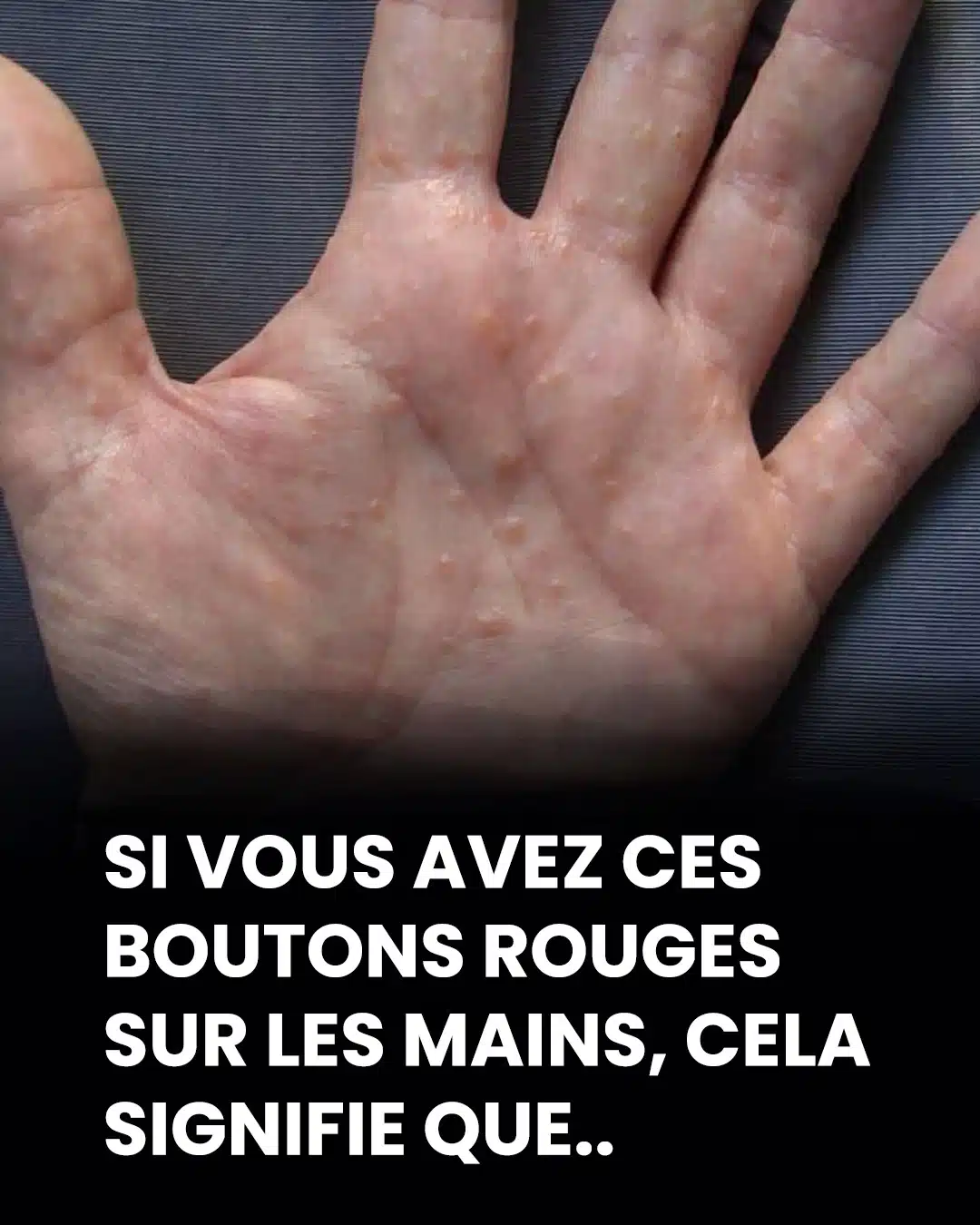 Si vous voyez ces boutons rouges dans les mains, voici ce que cela signifie réellement