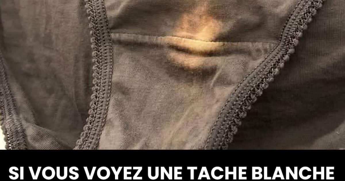 Tache blanche sur les sous vêtements : quelle signification ?