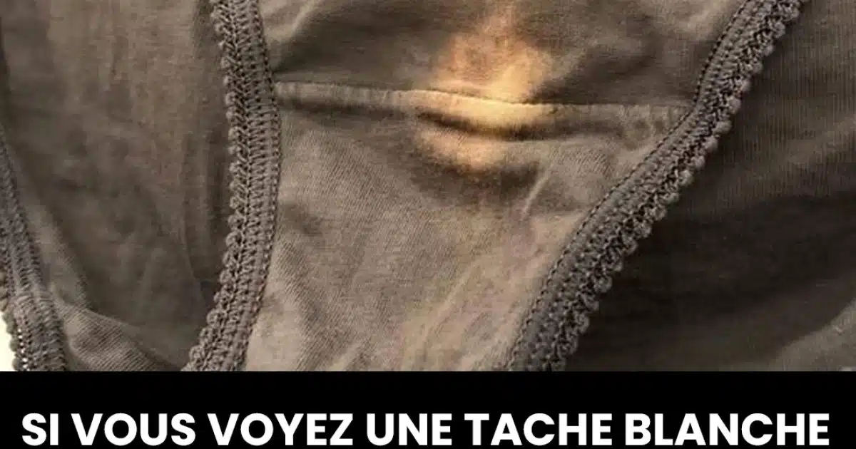 Tache blanche sur les sous vêtements : quelle signification ?
