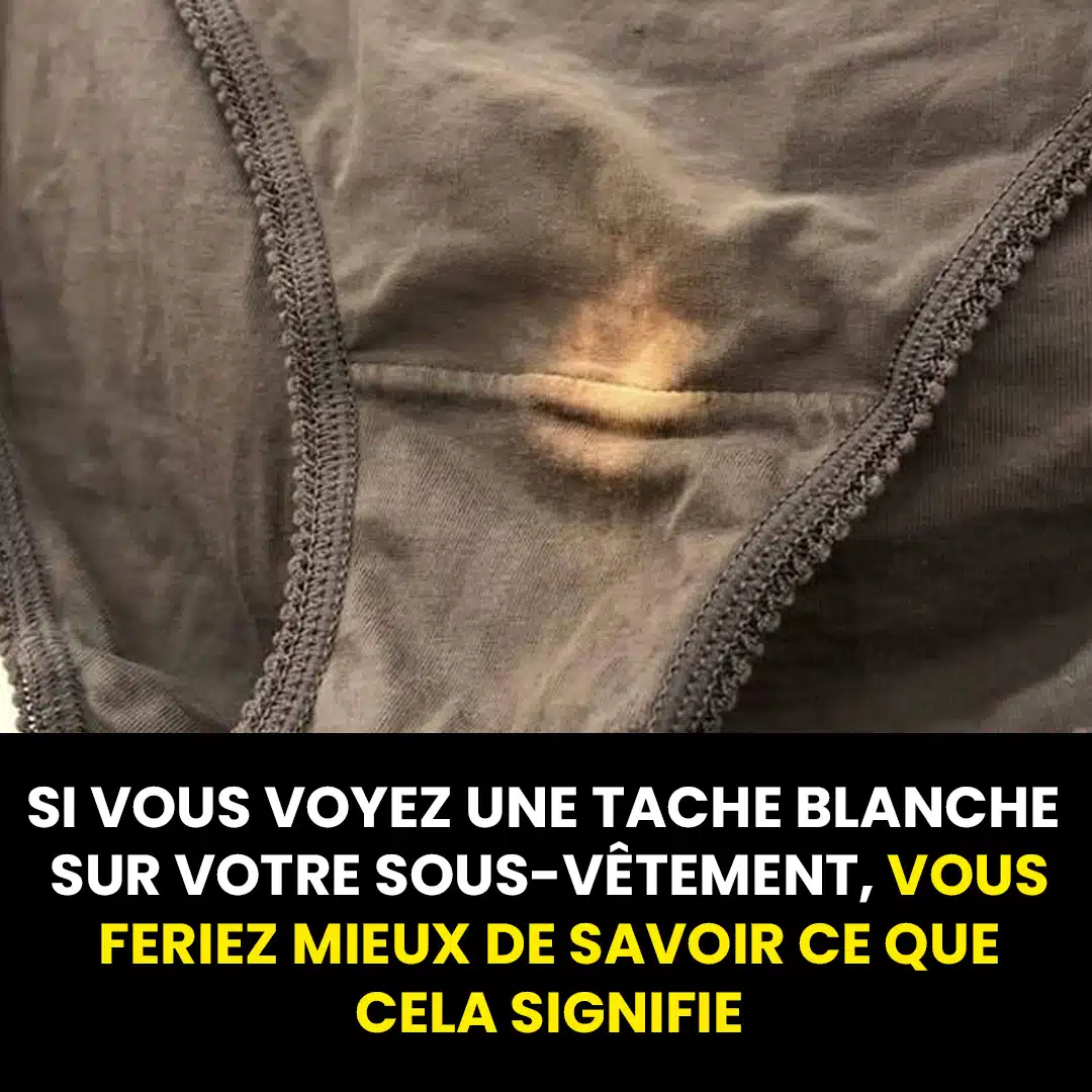 Tache blanche sur les sous vêtements : quelle signification ?