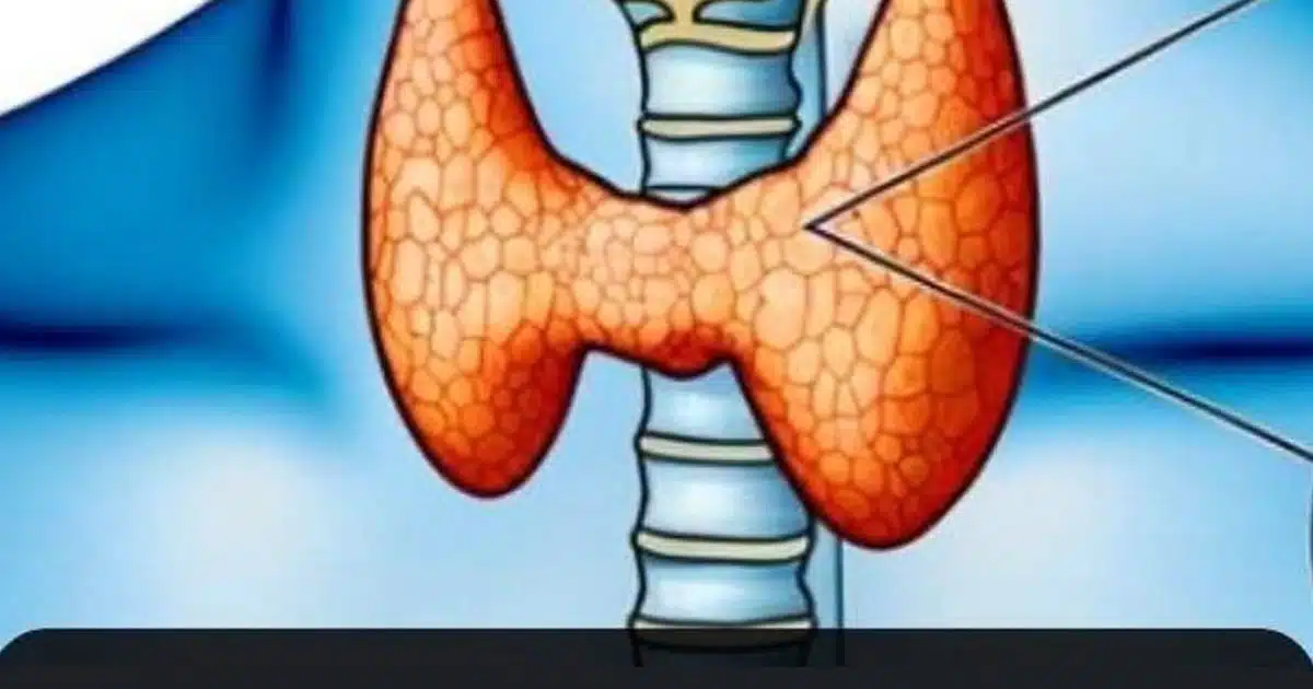 Thyroïde : 3 symptômes qui peuvent révéler un cancer
