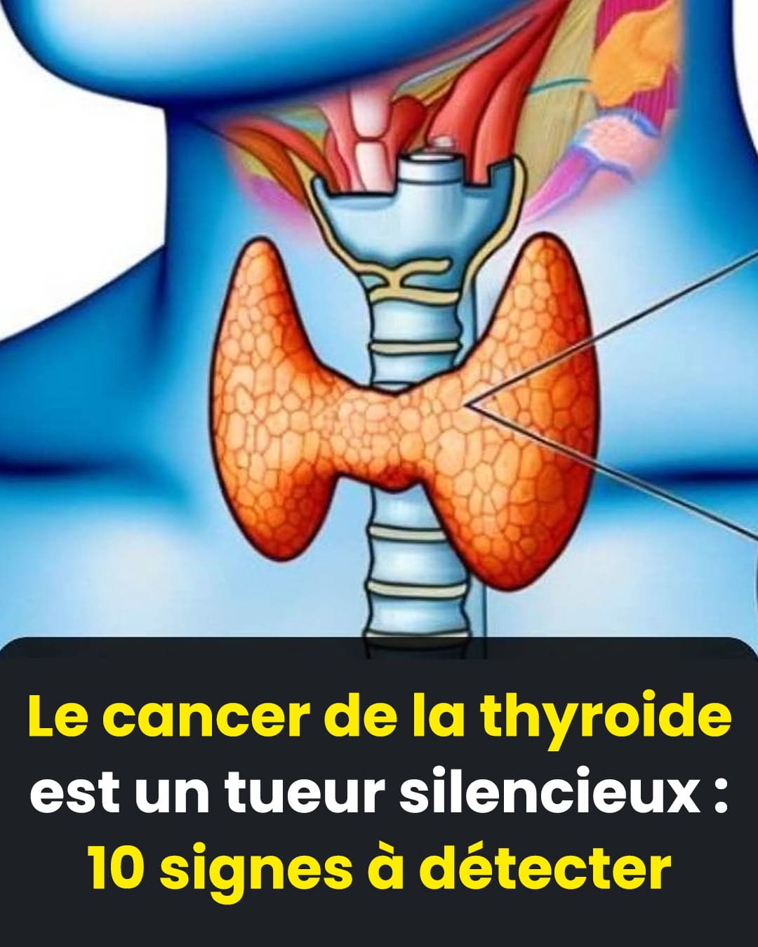 Thyroïde : 3 symptômes qui peuvent révéler un cancer
