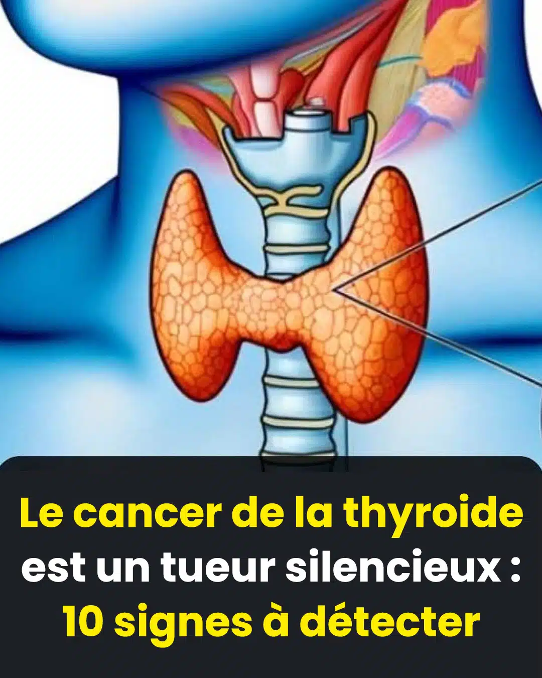 Thyroïde : 3 symptômes qui peuvent révéler un cancer