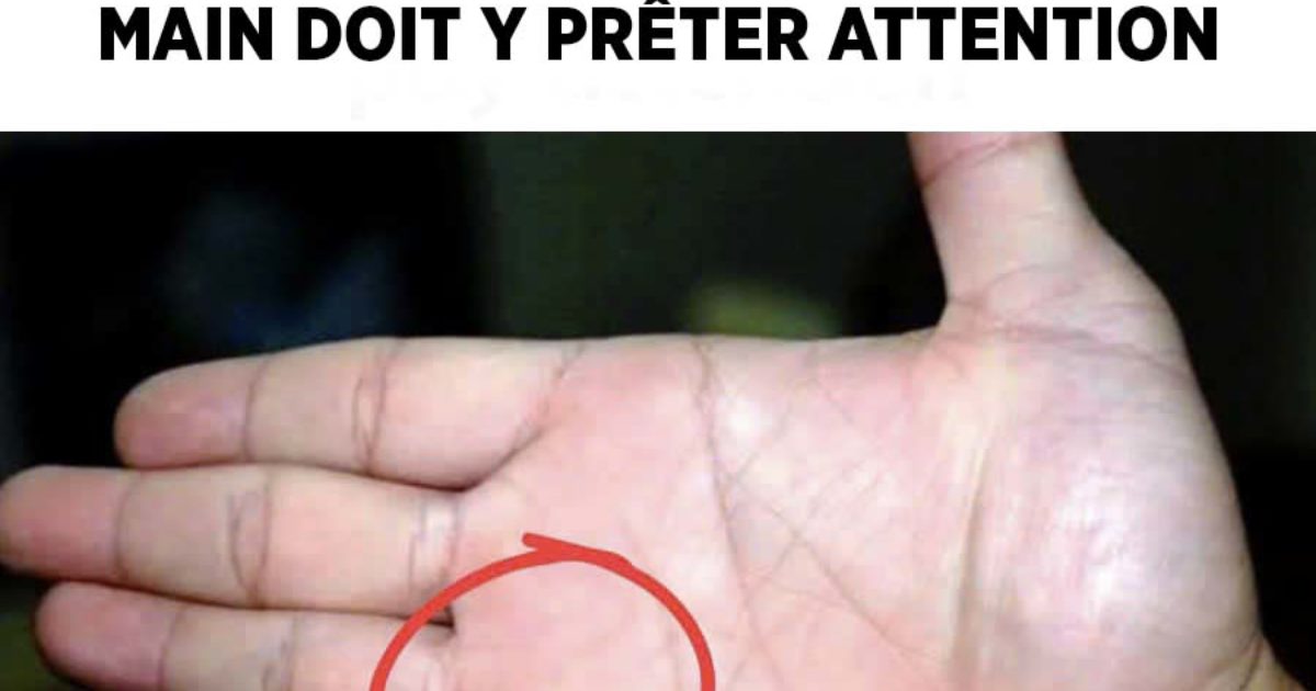 Toute personne ayant un grain de beauté sur la paume de la main devrait y prêter attention.