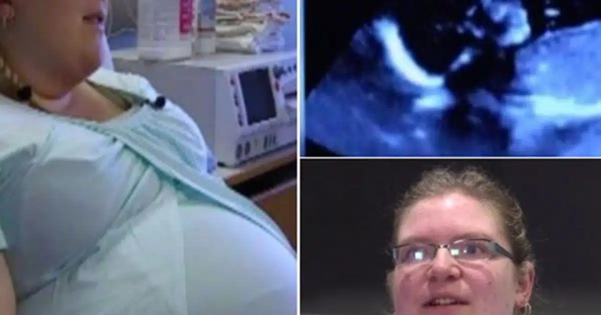 Un couple choqué en voyant l’échographie – puis l’infirmière déclare que c’est un cas sur 15 millions