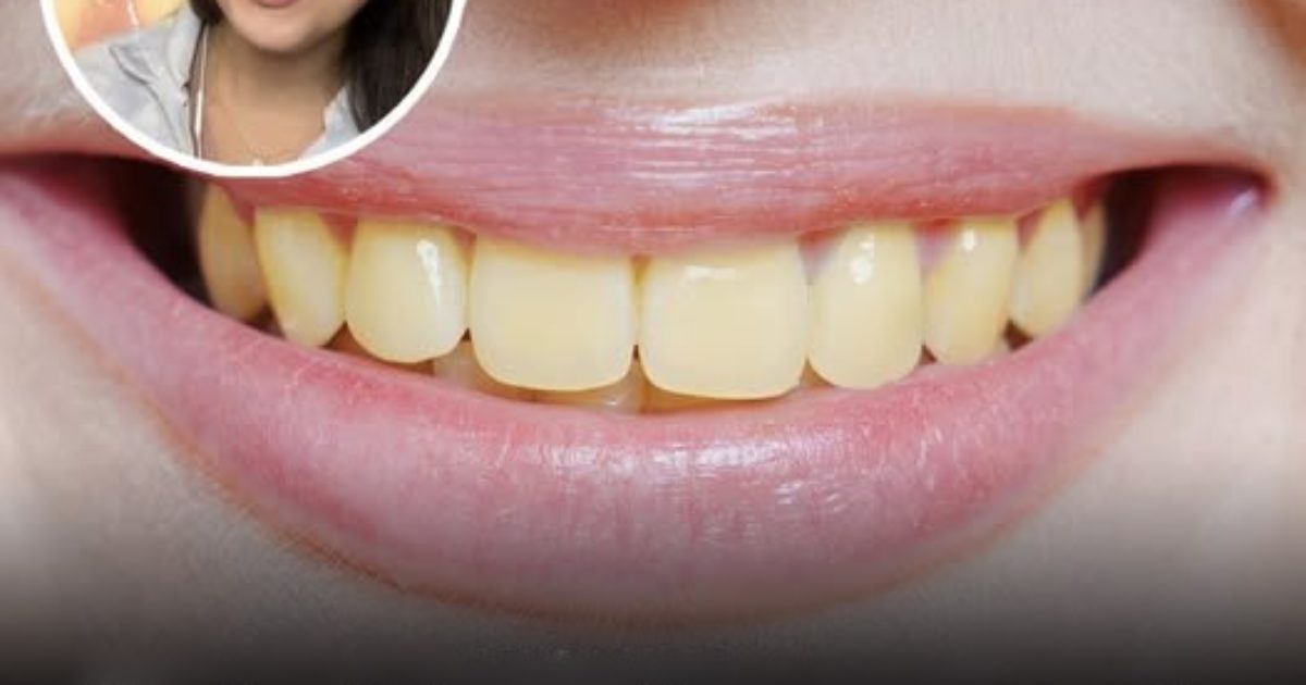 Un dentiste explique pourquoi vos dents sont jaunes même si vous les « brossez toujours »