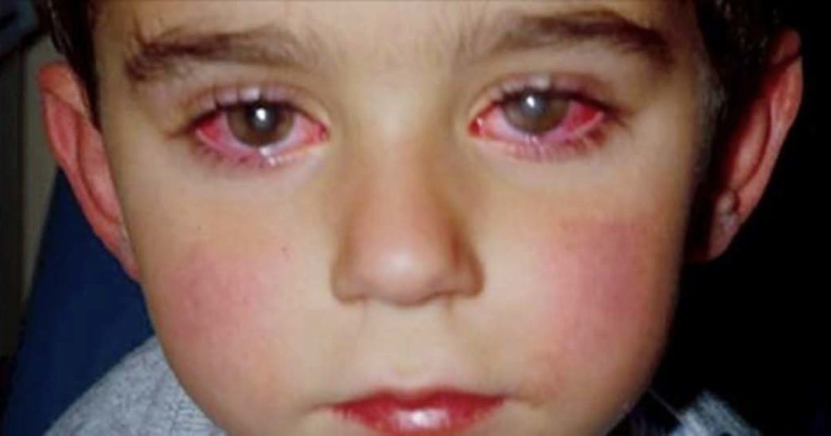 Un enfant a perdu 75 % de sa vue à cause d’un petit « jouet » qui se trouve dans tous les foyers