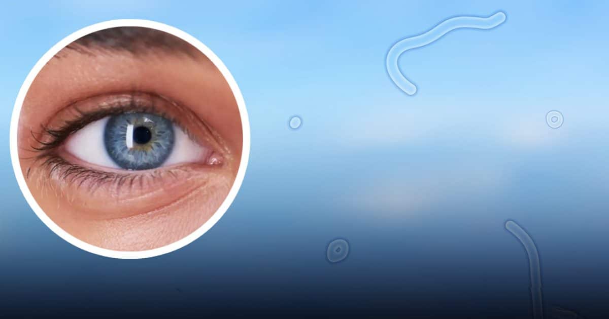 Un expert explique ce que vous devez faire si vous commencez à voir ces « corps flottants » dans vos yeux
