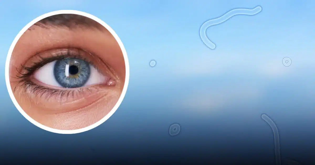 Un expert explique ce que vous devez faire si vous commencez à voir ces « corps flottants » dans vos yeux