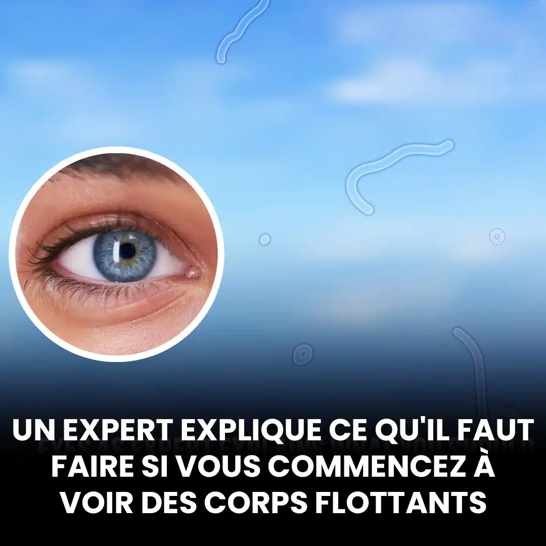Un expert explique ce que vous devez faire si vous commencez à voir ces « corps flottants » dans vos yeux