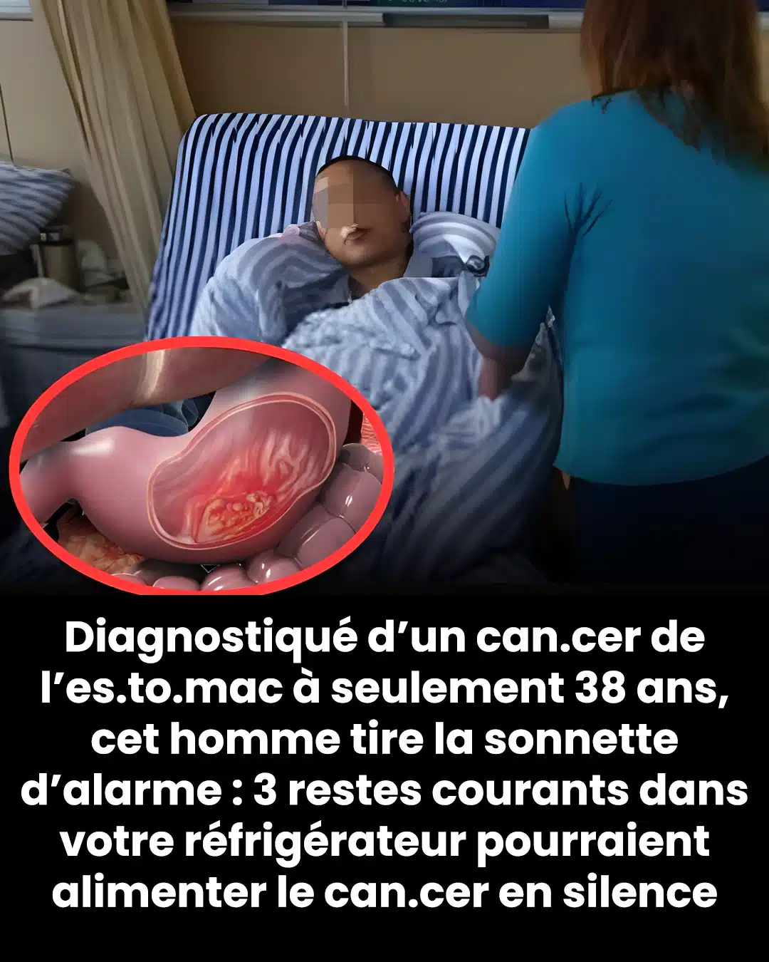 Un homme de 38 ans atteint d'un cancer de l'estomac met en garde : 3 aliments qu’il vaut mieux éviter