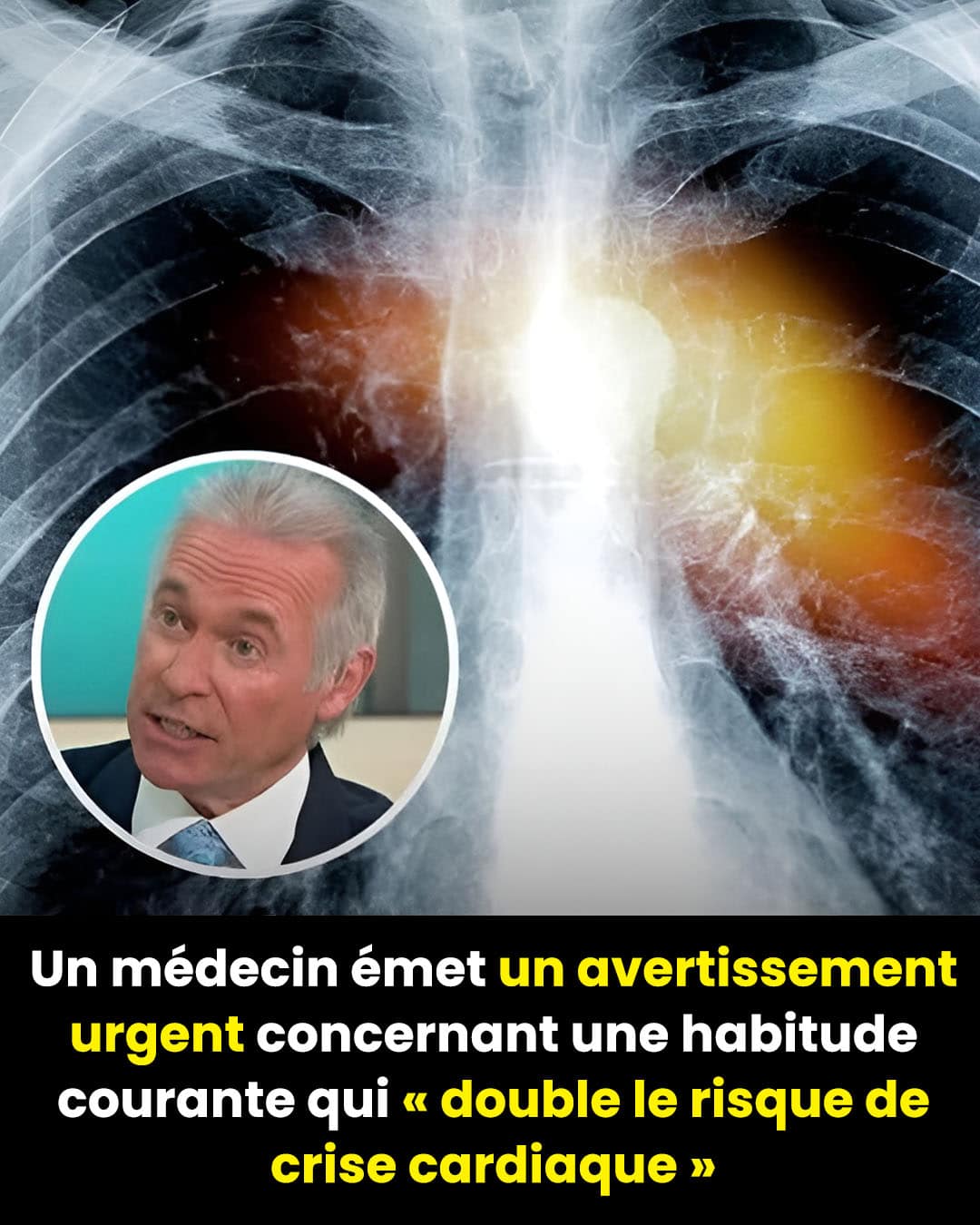Un médecin met en garde : cette habitude courante qui pourrait doubler votre risque de crise cardiaque