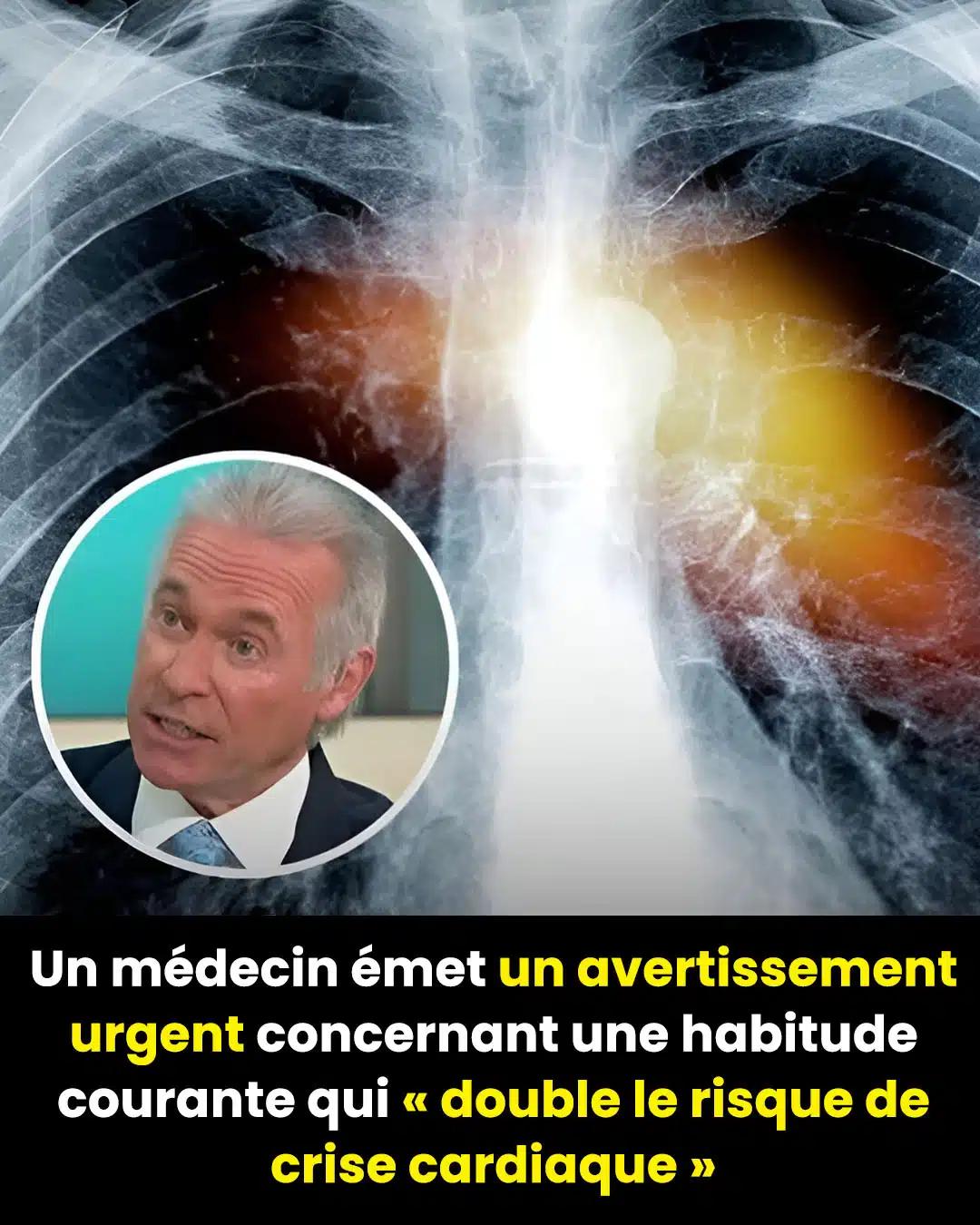 Un médecin met en garde : cette habitude courante qui pourrait doubler votre risque de crise cardiaque