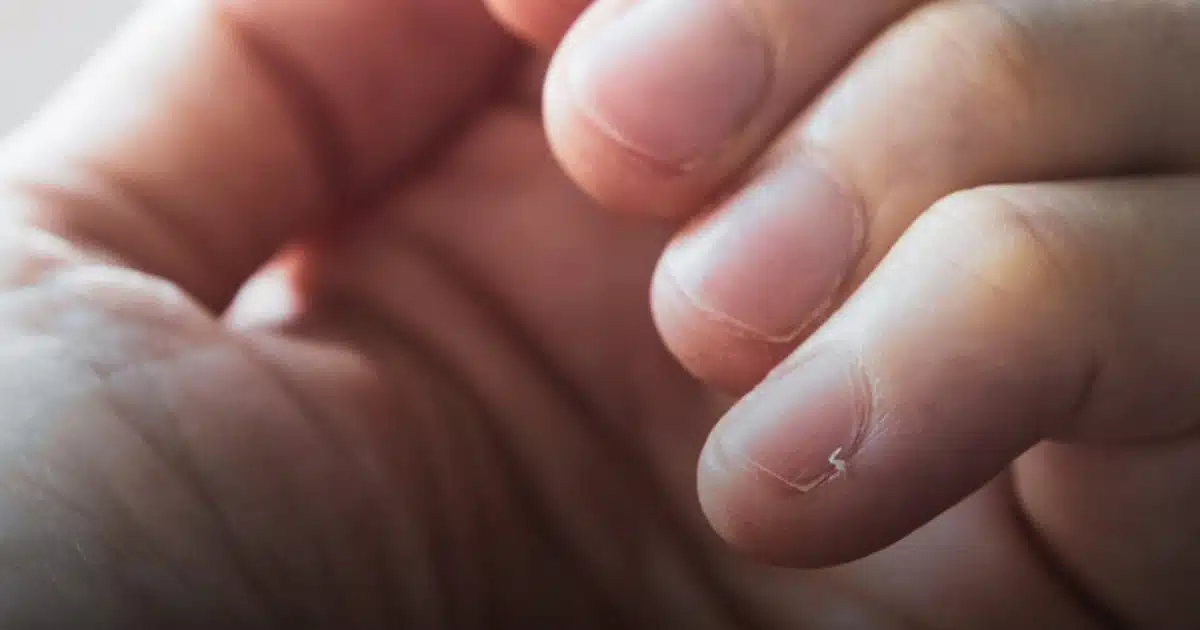 Un médecin révèle un signe clair sur vos ongles qui pourrait indiquer combien de temps il vous reste à vivre