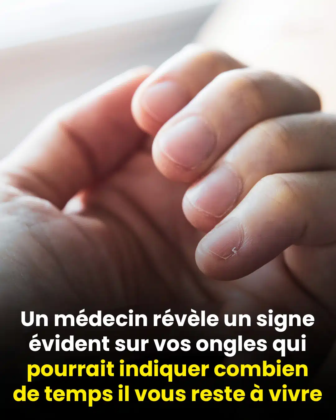 Un médecin révèle un signe clair sur vos ongles qui pourrait indiquer combien de temps il vous reste à vivre