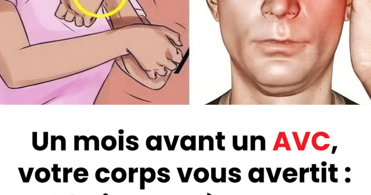 Un mois avant un AVC, votre corps peut émettre des signaux : voici 10 signes