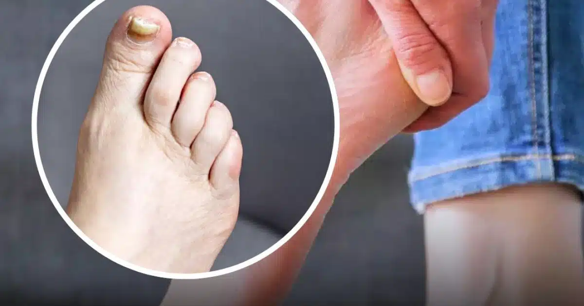 Un pharmacien révèle deux signes avant-coureurs d'un tueur silencieux que vous pourriez repérer dans vos pieds