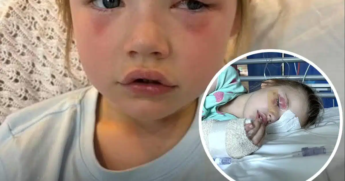 Un produit ménager courant rend une petite fille "aveugle d'un œil"
