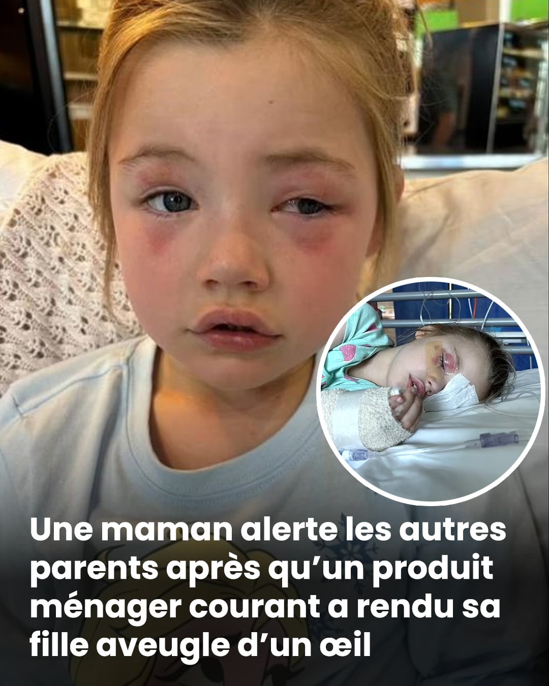 Un produit ménager courant rend une petite fille "aveugle d'un œil"