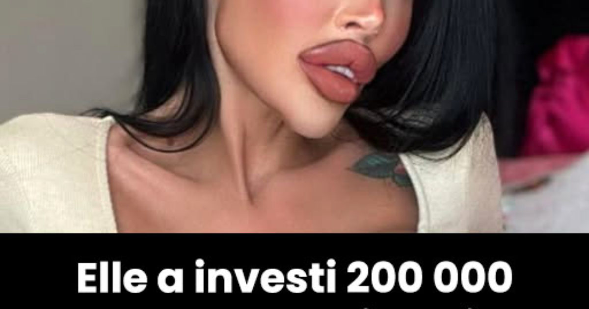 Une femme accro de la chirurgie plastique dépense 200 000 dollars en opérations