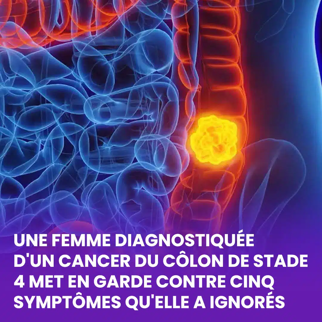 Une femme révèle cinq symptômes du cancer du côlon qu’il ne faut pas ignorer