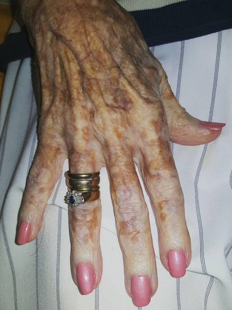 Main d'une personne âgée recevant un soin de manucure