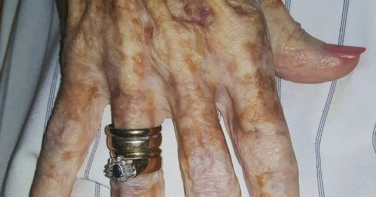 Une infirmière capture en photo la main d'une vieille dame et découvre ensuite un détail sur l'image qui devient viral sur Internet