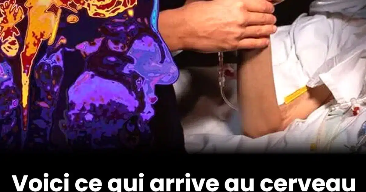 Une simulation époustouflante montre ce qui arrive à notre cerveau dans les 10 minutes après la mort