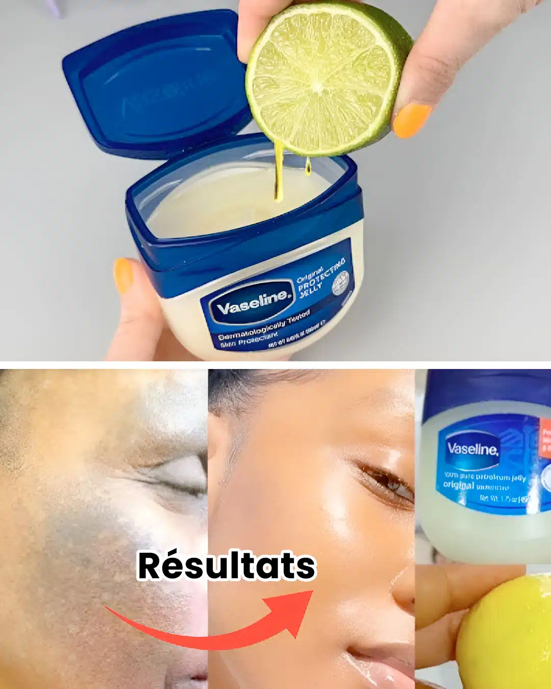 Vaseline et citron : l’astuce maison pour une peau sublime