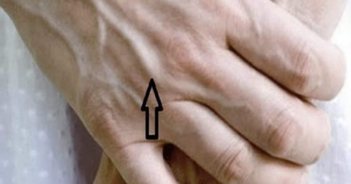 Veines visibles : quelles significations ?