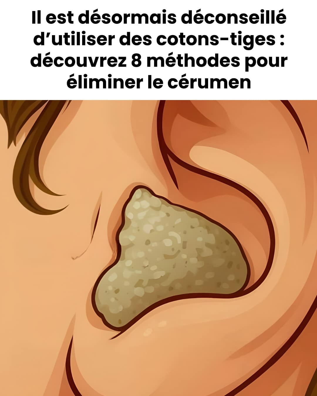 Voici 8 méthodes simples et sûres pour éliminer l'accumulation de cérumen